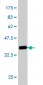 GBA Antibody (monoclonal) (M01)